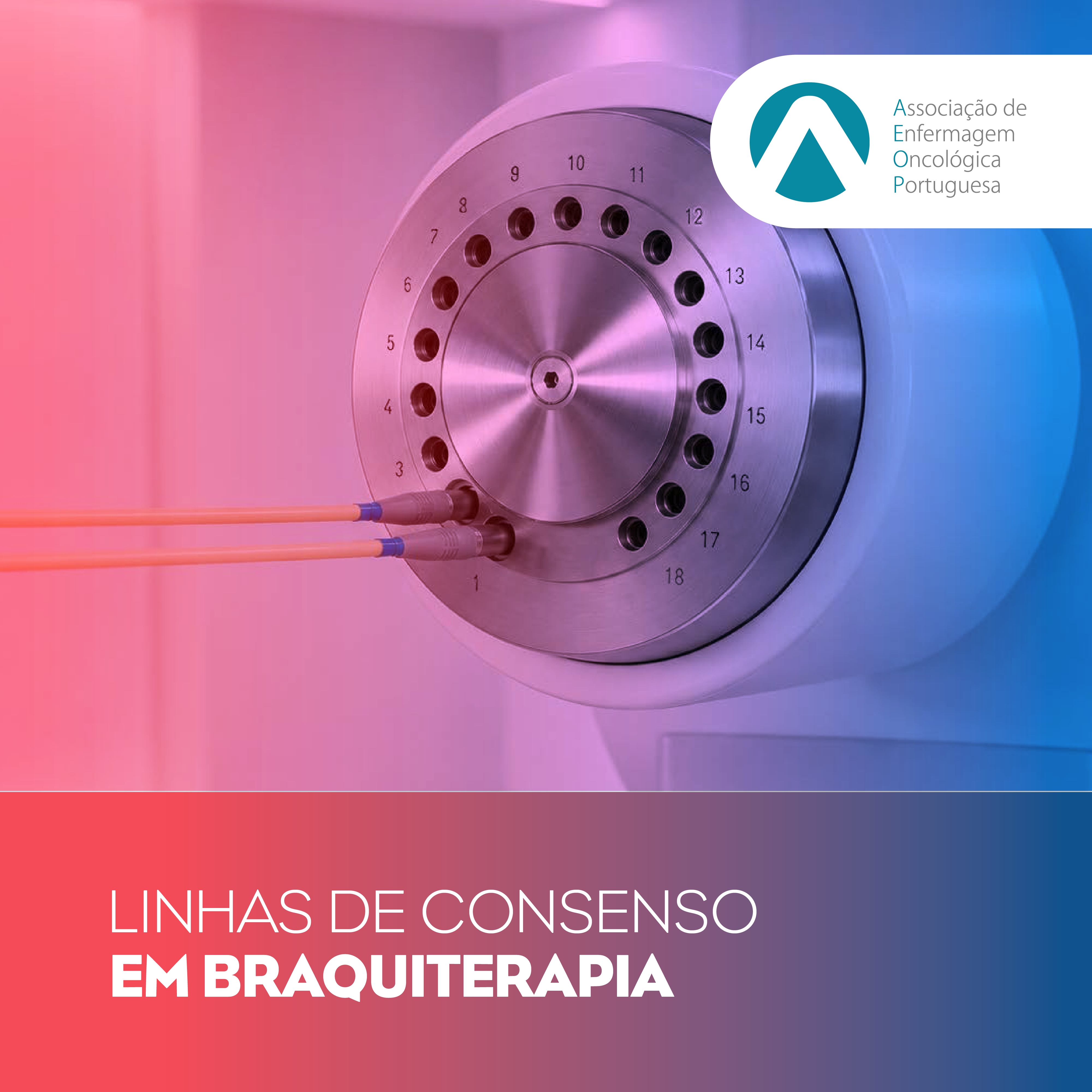 Linhas de Consenso em Braquiterapia